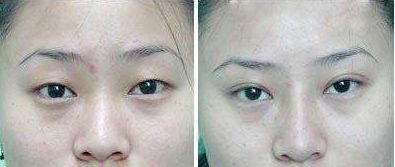 武警廣西總隊醫(yī)院怎么樣？武警廣西總隊醫(yī)院簡介|醫(yī)生團隊|口碑評價！