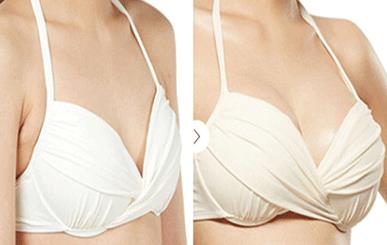 2023重慶冷凍法去黃褐斑強(qiáng)榜前十強(qiáng)的醫(yī)生(邵雅娟、吳細(xì)輕、劉玉婷評價一致贊美)