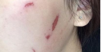 石家莊雅芳亞醫(yī)療美容醫(yī)院的醫(yī)院簡(jiǎn)介及醫(yī)生資料是什么？