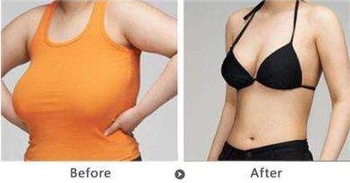 深圳雙眼皮修復(fù)哪家好？機(jī)構(gòu)排名及評(píng)價(jià)調(diào)查報(bào)告