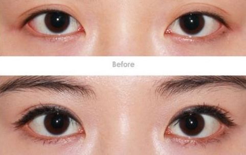 沈陽市整形外科醫(yī)院哪家效果好，口碑最佳？