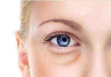 張娟醫(yī)生做雙眼皮術(shù)效果如何？