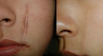 蘭州眼部修復(fù)手術(shù)哪家好？眼部整形專(zhuān)家為您推薦最佳選擇！