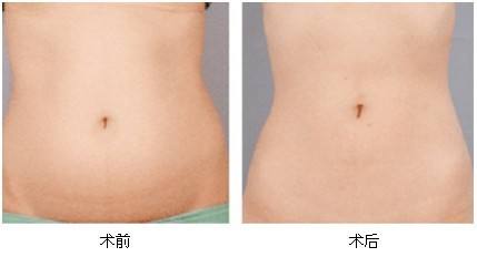 2023湘潭彩光美白嫩膚專家前10位排行榜(劉佑文、熊宜文、熊志能幫你圓夢)