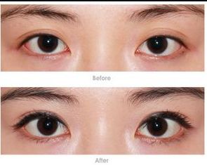 鄭州整容醫(yī)院哪家好？教你如何選擇適合自己的整容醫(yī)院