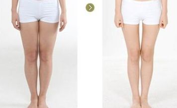 貴州整容醫(yī)院哪家好？權(quán)威專家為您推薦