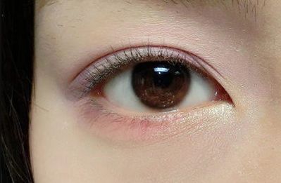 王世虎拉皮和脂肪填充的效果如何？有哪些多樣化的項目值得選擇？技術(shù)是否可靠可證？