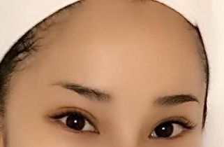 上海醫(yī)院最好治療皮膚疤痕的專科是哪家？