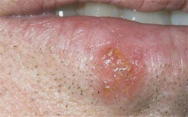 2023新疆水光針祛除唇紋醫(yī)生排行榜前十強(張傳功、李朝陽、張偉詳細資料)