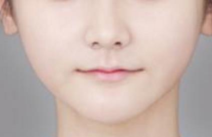 中國比較好的拉皮手術專家排行榜發(fā)布！這3位醫(yī)療大師居結(jié)果榜首