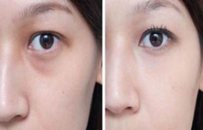 上海整形私密醫(yī)院排名及口碑，哪家好？