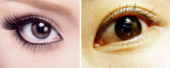 安徽省哪家醫(yī)院割雙眼皮效果最好，技術(shù)最先進(jìn)，口碑最好？