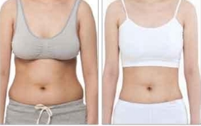 馬曉輝：301醫(yī)院整形專家正式亮相！正頜手術(shù)效果搶眼，手術(shù)案例推薦！