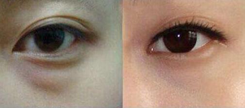 上海更受推薦的隆胸專家排行榜！王濤、江華等5位魅力無限，非?？孔V！