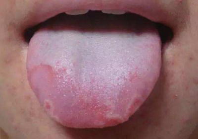 2023宜賓自體脂肪填充眼窩正規(guī)專家推薦前10位(尤軍、詹清、王喬干貨帖收藏)