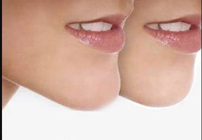 上海除疤痕哪家醫(yī)院好？選擇這家專(zhuān)業(yè)醫(yī)院，讓你告別疤痕煩惱！