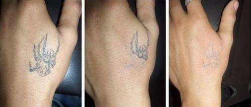 商丘市整容醫(yī)院哪家好？綜合評(píng)價(jià)一覽，找到適合您的理想之選！