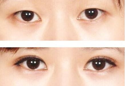 榆林市美容哪家醫(yī)院好？榆林市頂級(jí)美容醫(yī)院推薦