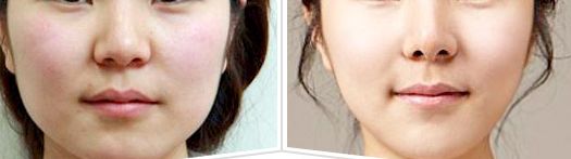 廣西哪家整形美容科醫(yī)院值得選擇？