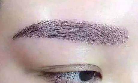 穆寶安拉皮術(shù)：北京抗衰行家評價及手術(shù)費用、醫(yī)院選擇指南