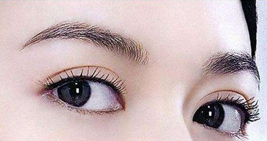 深圳哪家醫(yī)院的雙眼皮手術(shù)效果好？