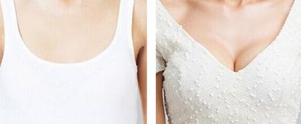 上海抽脂整形醫(yī)院排名2023：哪家好且性價比更高？