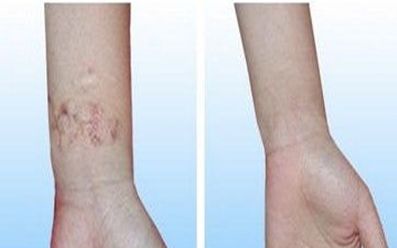 濟(jì)寧去雀斑醫(yī)院哪家好？揭秘濟(jì)寧市治療雀斑效果最好的醫(yī)院