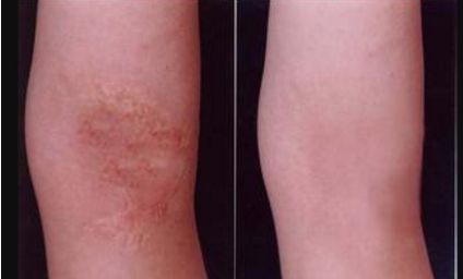 河北雙眼皮手術(shù)哪家好？挑選專業(yè)技術(shù)與良好口碑并存的醫(yī)療機(jī)構(gòu)！