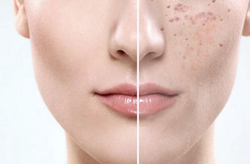 福建泉州海峽醫(yī)療美容醫(yī)院怎么樣？福建泉州海峽醫(yī)療美容醫(yī)院簡介|醫(yī)生團隊|口碑評價！