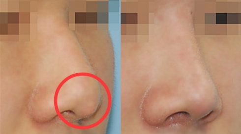 福州哪家醫(yī)院做疤痕好？比較全面的福州疤痕治療醫(yī)院推薦給您！