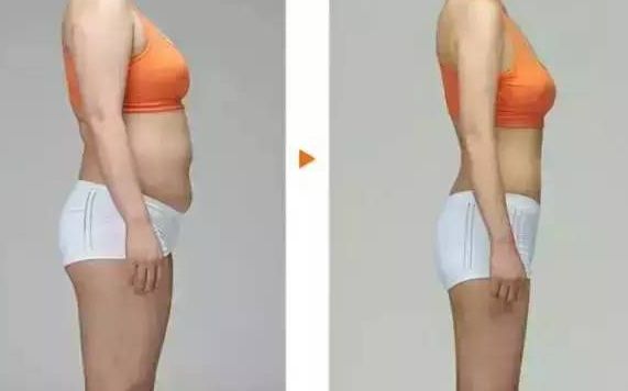 深圳哪家醫(yī)院能夠優(yōu)質(zhì)完成正頜手術(shù)？