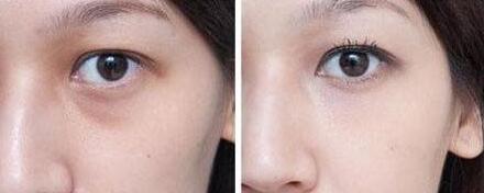 同濟吳毅平醫(yī)生：擅長面部年輕化，口碑怎么樣？同濟吳毅平醫(yī)生，技術(shù)高超面部年輕化效果顯著