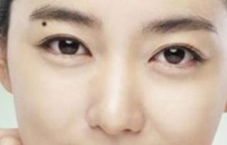 認識眼部大咖，探索秦宏偉醫(yī)生的簡介及雙眼皮案例分享