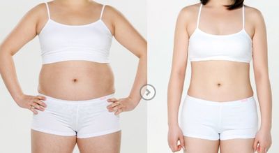 蘇州祛斑好醫(yī)院哪家好？專(zhuān)家推薦：蘇州效果好的祛斑醫(yī)院排行榜