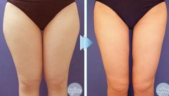 大連專業(yè)祛斑哪家醫(yī)院好？祛斑效果最好的醫(yī)院有哪些？