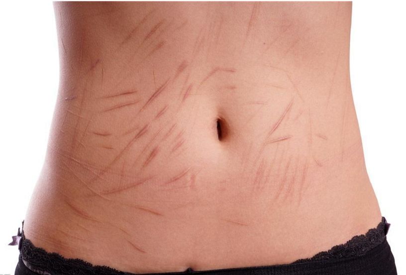 南京抽脂手術(shù)那家醫(yī)院技術(shù)靠譜？哪家醫(yī)院的抽脂效果好？