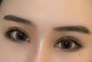 貴陽梁安裕醫(yī)生技術(shù)在線解析腹壁成型效果，怎么樣？