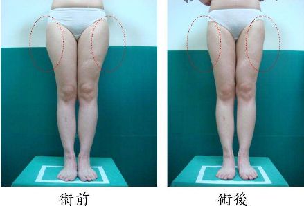 昆明哪家治痘痘好的醫(yī)院，痘痘問題如何有效解決？