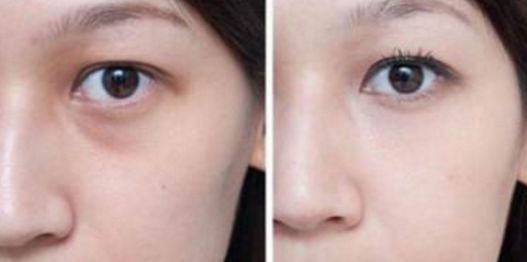 武漢看胎記醫(yī)院哪家好？綜合醫(yī)療機構(gòu)排行榜詳細(xì)解讀