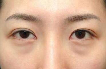 杭州面部提升醫(yī)生和專業(yè)醫(yī)院介紹，了解小拉皮技術(shù)好的醫(yī)生