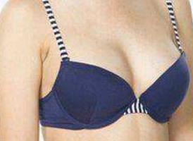 2023長(zhǎng)沙手術(shù)祛除眉間紋前10強(qiáng)的專家(李平珍、張峰、向才錦這些醫(yī)生口碑靠前)