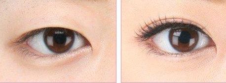 上海哪家醫(yī)院做處女膜修復(fù)好？