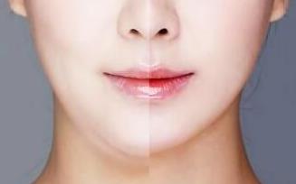 2023杭州微創(chuàng)額頭紋手術(shù)專家TOP10強(qiáng)上榜名單(李大琦、羅麗娟、黃發(fā)明實(shí)力口碑超好！)