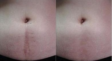 宜昌眼科醫(yī)院哪家好，專業(yè)眼科醫(yī)生助您解答