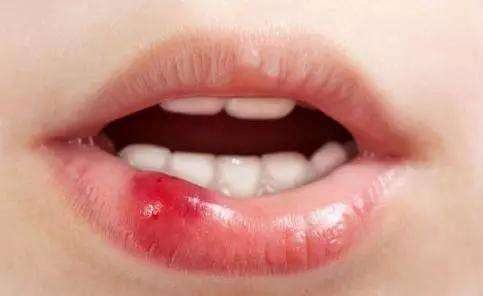 2023天津注射豐蘋果肌專家上榜TOP10(趙冰清、莊志、宮勝利匯總不分先后，實力杠杠滴！)