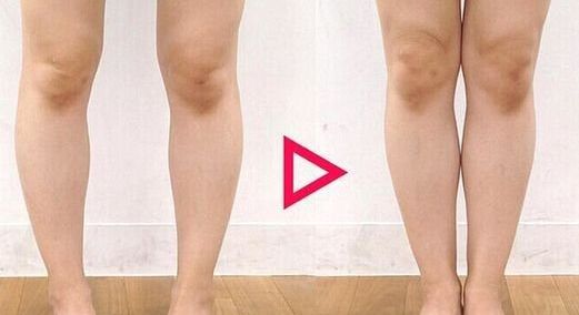 南昌二附院整形科腰腹吸脂是否可靠？醫(yī)生專業(yè)解讀幫您解答