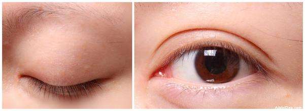 2023昆明隔空溶脂瘦肩部醫(yī)生top10強(qiáng)排名(李明、唐欽、任德浩榜首屬實(shí)意外)