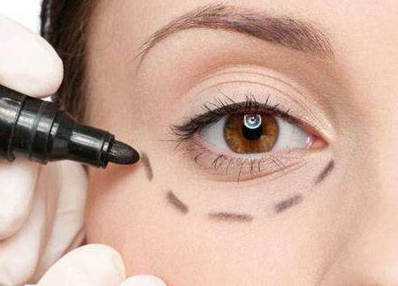 蘇州哪位醫(yī)生修復(fù)雙眼皮失敗靠譜？案例分享有人氣！