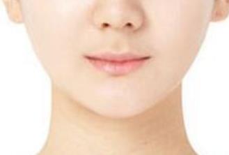 上海第九人民醫(yī)院李圣利：坐診時間、醫(yī)生簡介與雙眼皮案例介紹