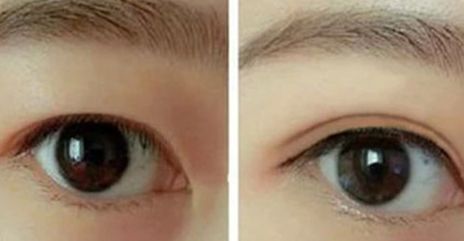 杭州同榮麗格郭同榮抽脂效果如何？醫(yī)生評價怎樣？